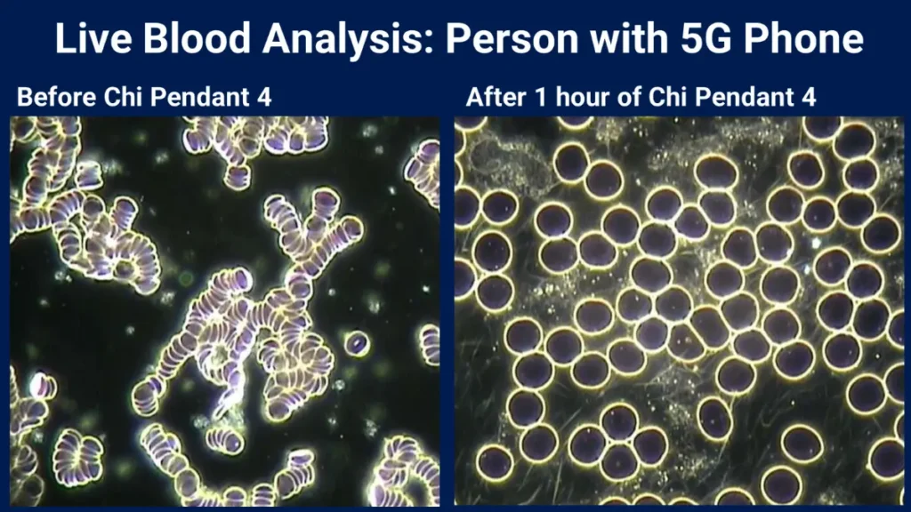 Live blood analysis Before and After Amezcua use 